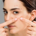 Bingung Cari Skincare untuk Mengatasi Jerawat? Ini Tips dari Safi